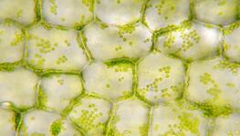 Plant cells & algae